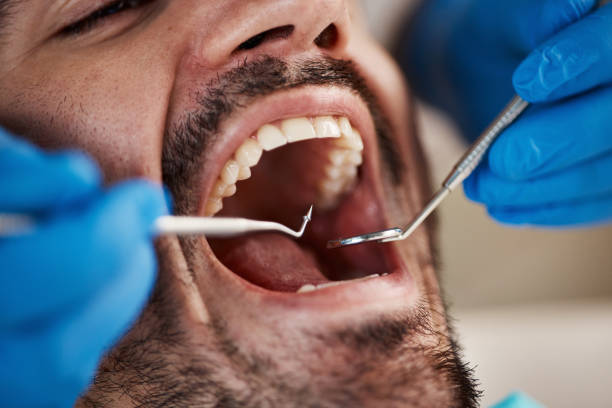 Best Emergency Gum Treatment in Harrisburg, PA